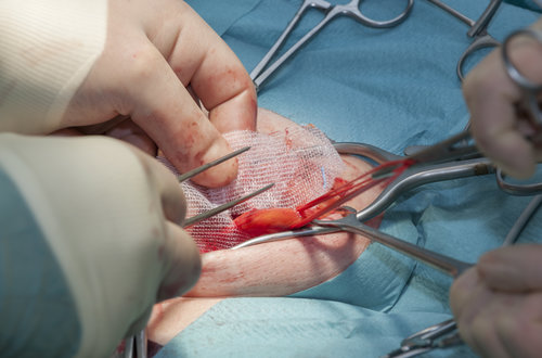 Urology at Paarasmani Hospital Pune, Hadpsar